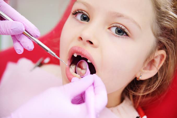 Why Yorkshire Has England's Highest Child Tooth Decay Rate, and What Actually Prevents It